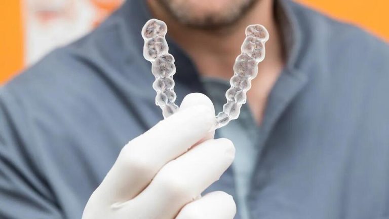 How Long Does It Take Invisalign? Experts Compare Its Timeline