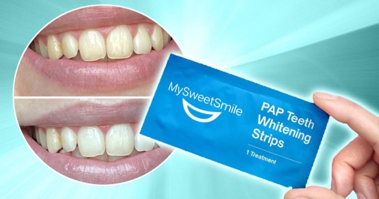 I Tried The Teeth Whitening Strips That Users Call "the