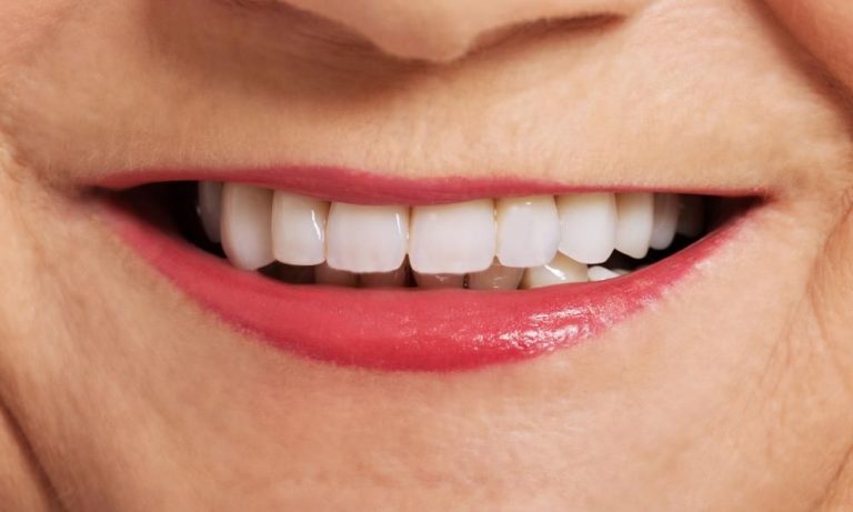 Is The Trend For Perfect Teeth Over?