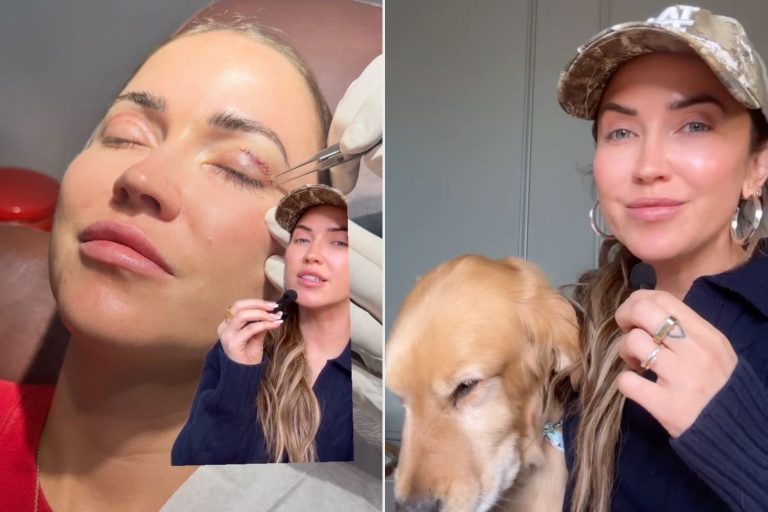 Kaitlyn Bristowe Says Her Dog Destroyed Her Eye After Her