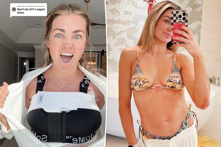 Lindsay Arnold Shows Off Breast Implants After Hater Says She'll