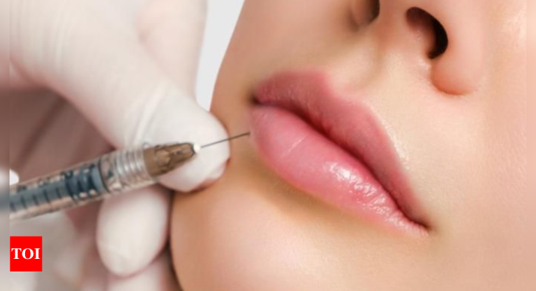 The Rise Of Lip Augmentation: Why Fuller Lips Are Here