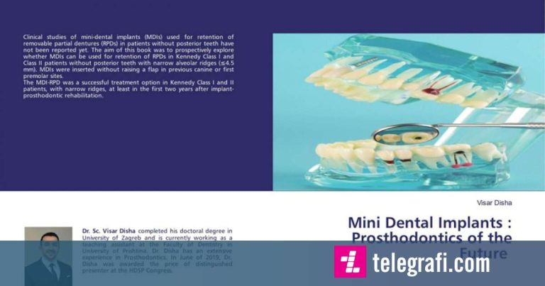 The Book "mini Dental Implants: Prothodontics Of The Future" By