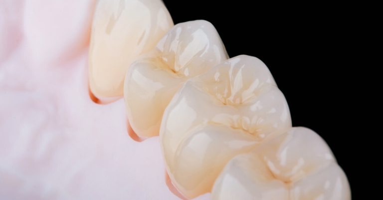 3d ceramics print the promise of dental restorations