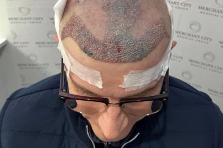 Glasgow's man "incapable of working" after damaging hair, leaves him