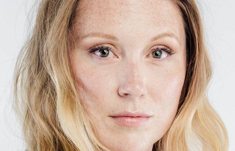 How much does the eyebrow lift in 2024?