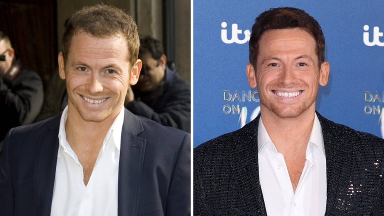 Does joe swash have a hair transplant? the actor's new