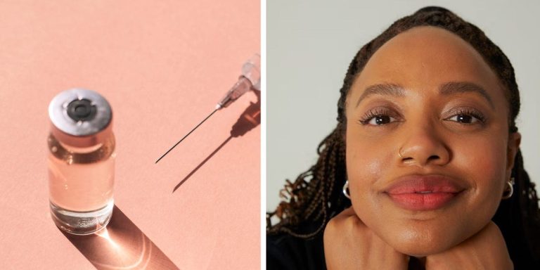 I got botox for the first time in my 30s: