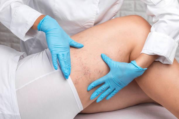 The Treatment Market with Chinese veins to reach $ 2.61 billion by 2034, by 2034, The treatment market with chinese veins to reach $ 2.61