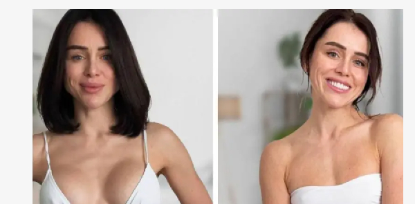 Why More Women’s Breast Implants Comot Dia? Why more women's breast implants comot dia?
