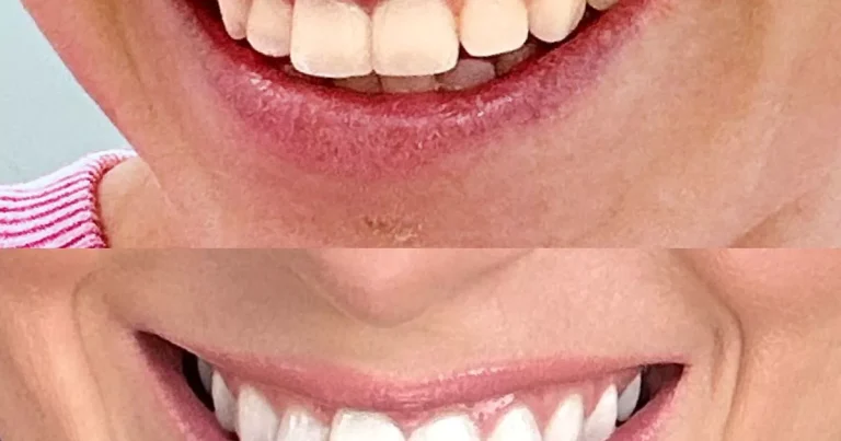 Buyers are preparing for vacation with teeth whitening kits say