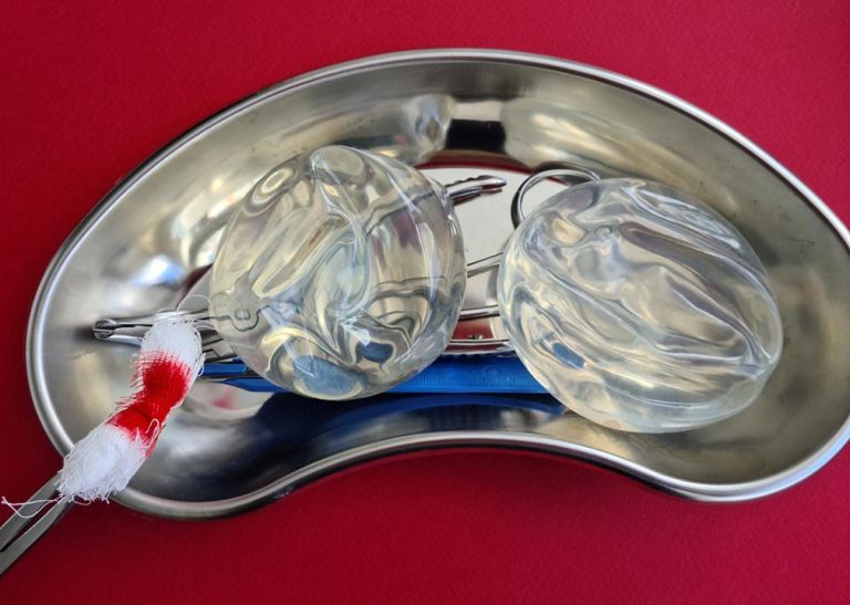 Fooling trend: more americans remove their breast implants