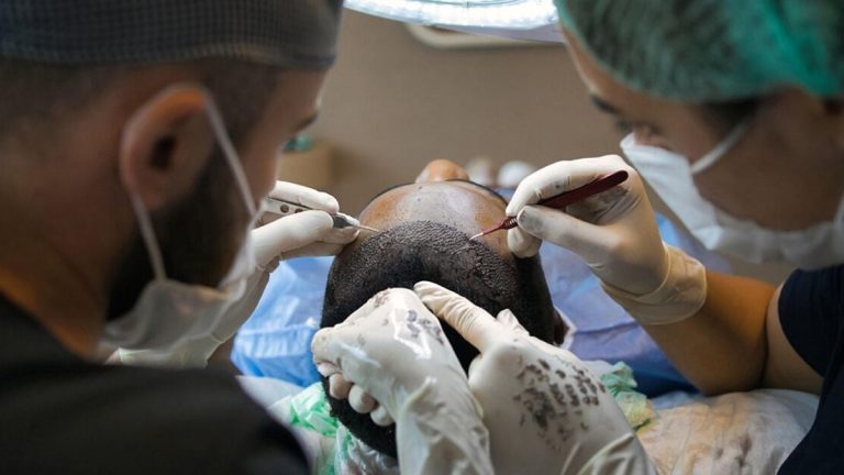 How safe is this cosmetic process? – firstpost How safe is this cosmetic process? firstpost