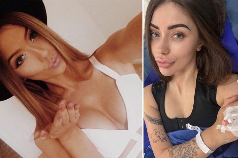 Influence sued the surgeon after excessively large breast implants of