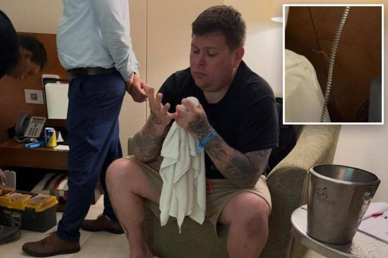 The tourist “almost burned alive” after electric shock through his teeth filling at the five -star resort The tourist "almost burned alive" after electric shock through his