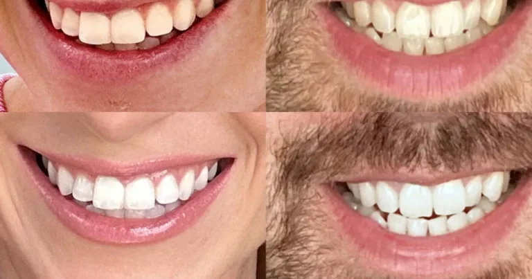Whiter buyers' teeth every day “with the lowest” price