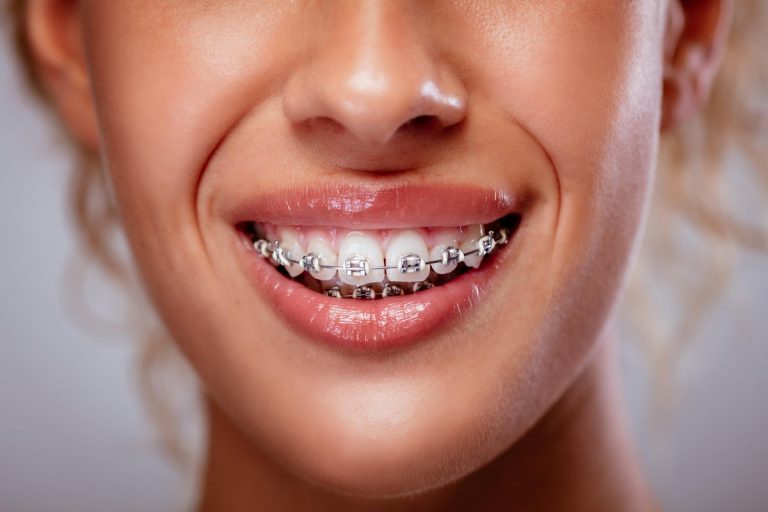 TKA REPORT: What causes the sometimes painful state and how to fix it Tka report: what causes the sometimes painful state and how