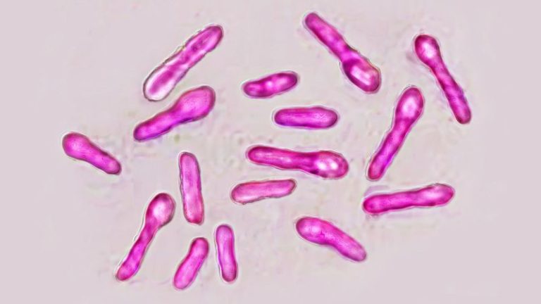 Botulism: dozens in northeast england report symptoms of potentially fatal