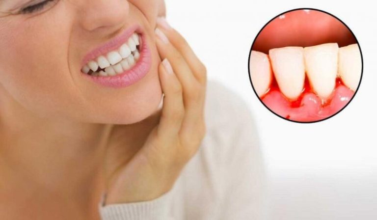 The gingivitis treatment market is increased due to enhanced oral