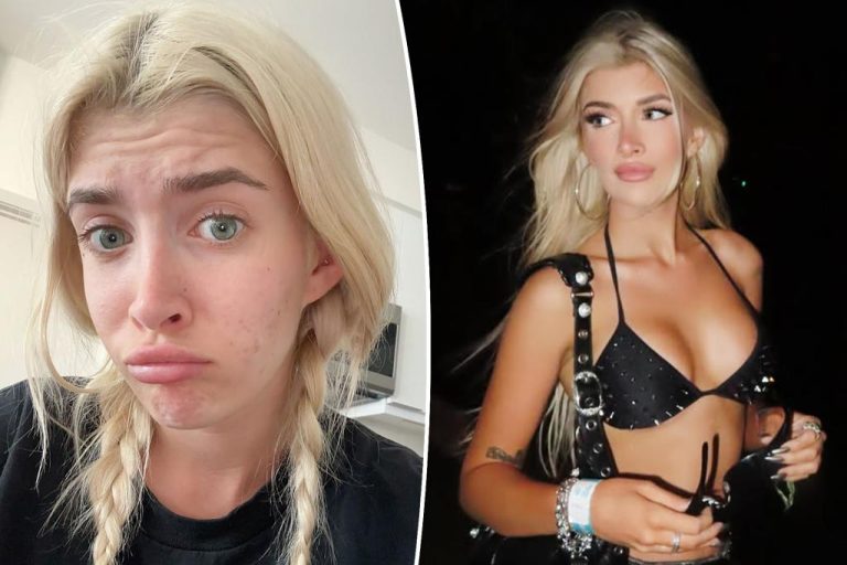 Why sami sheen wants to delay the removal of breast