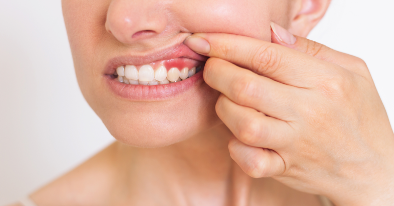 Gum disease treatment: deep cleaning, surgery and prevention