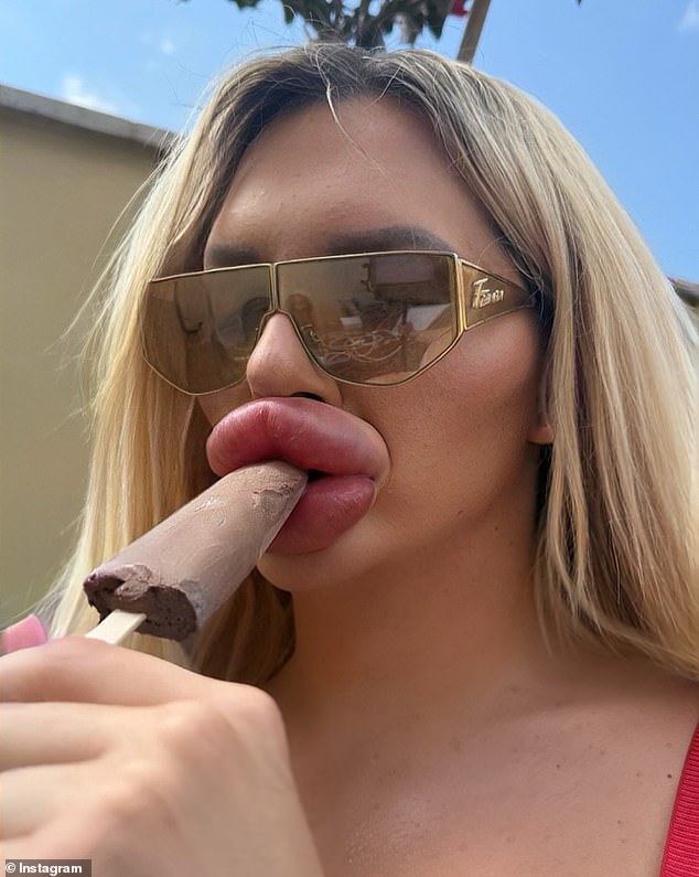 I had so many lips I have trouble breathing and I can’t close my mouth … but I don’t have plans to stop I had so many lips i have trouble breathing and