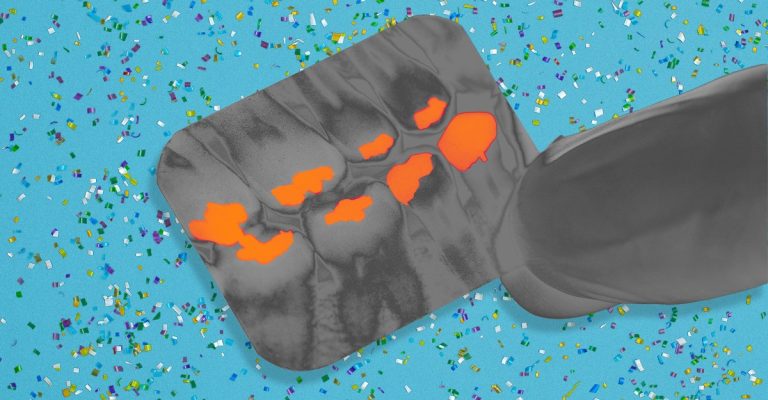 Modern dentistry is a microplastic minefield