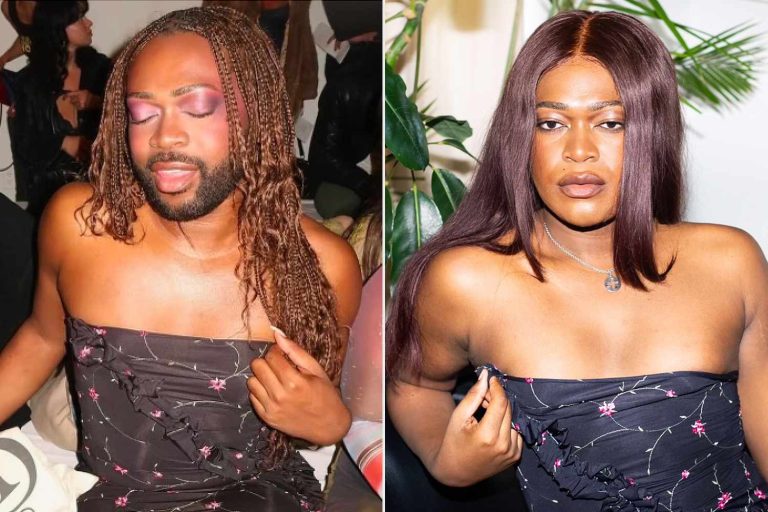 The trans influencer shares before and after photos of non
