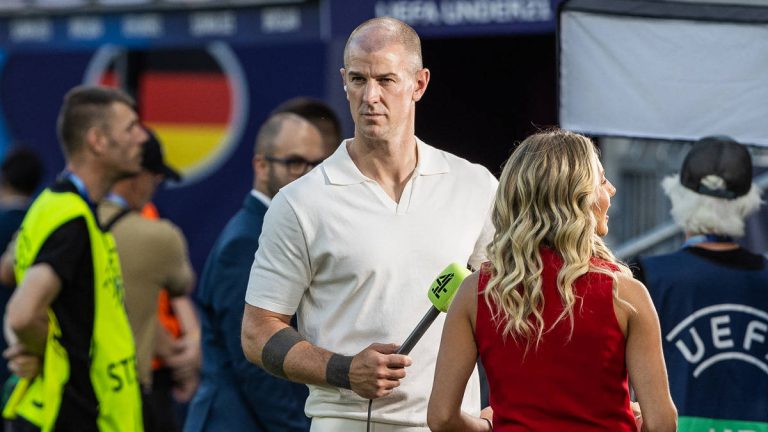 Who is joe hart and had a hair transplant?