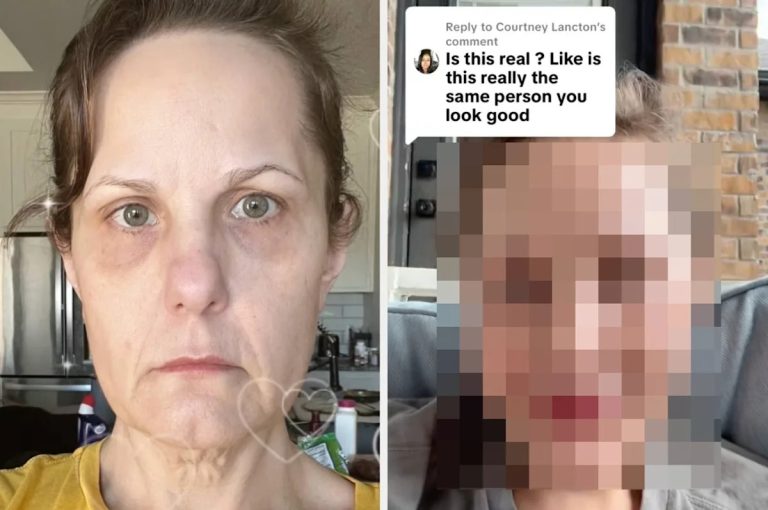 Woman's mexican facelift has results so shocking, she has left