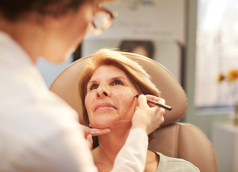 A transformative deep level facelift
