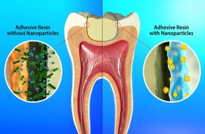 Basic2Breakthrough: The journey of a dentist to save your teeth Basic2breakthrough: the journey of a dentist to save your teeth