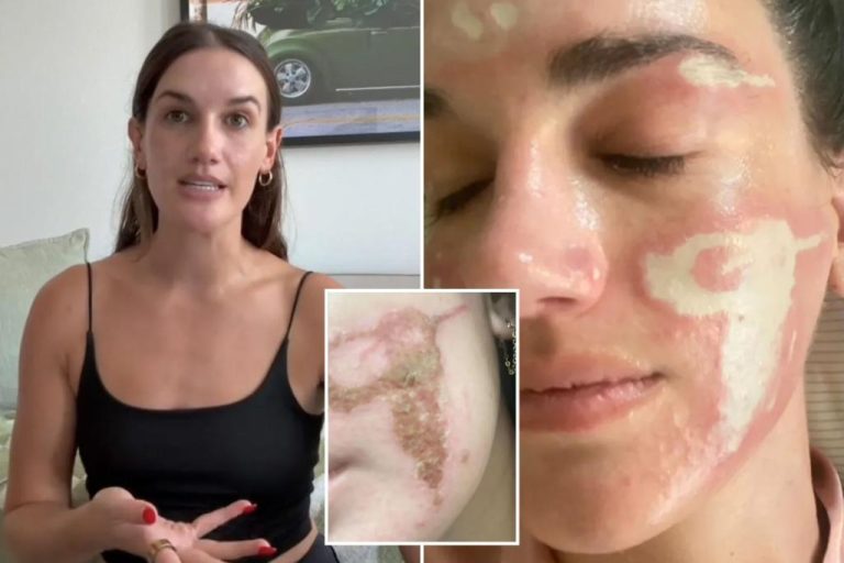 Celeb Esthetician Sonya Dakar let me burn and signal, says the customer Celeb esthetician sonya dakar let me burn and signal, says