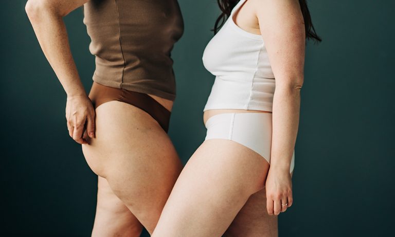 Data proves that cellulite is the top concern for women