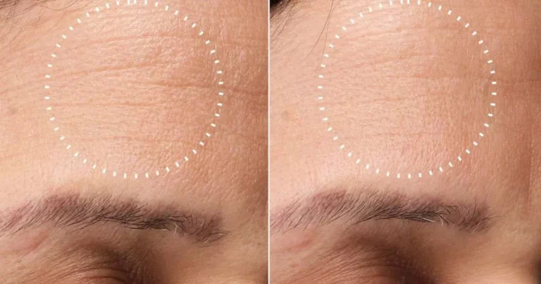 Get 'brighter skin' in a budget with a reduced medik8