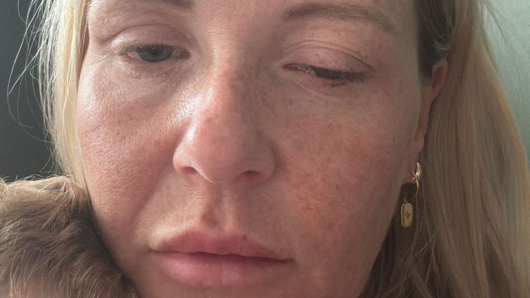 Injections that resemble unauthorized injections cause outburst of diseases that
