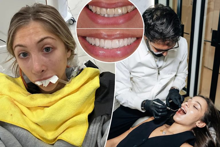 'my mouth is permanently submerged'