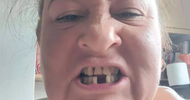 NHS worker refused UK treatment flies to Croatia for new teeth Nhs worker refused uk treatment flies to croatia for new