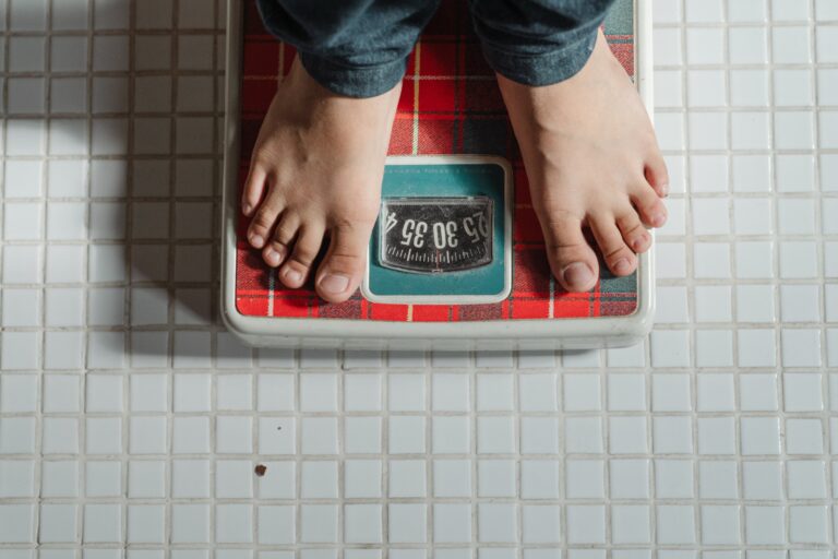 Patients continue to lose weight years after tummy tuck