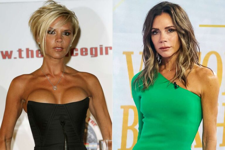 Victoria beckham reveals why she had her breast implants removed