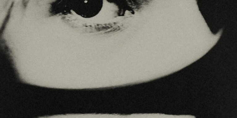 Why does everyone have upper blepharoplasty surgery?