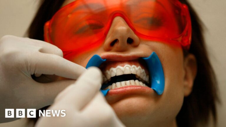 BBC investigation exposes the dangerous teeth whitening industry BBC investigation exposes the dangerous teeth whitening industry