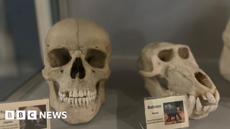 Discovery about King's College scientists' teeth