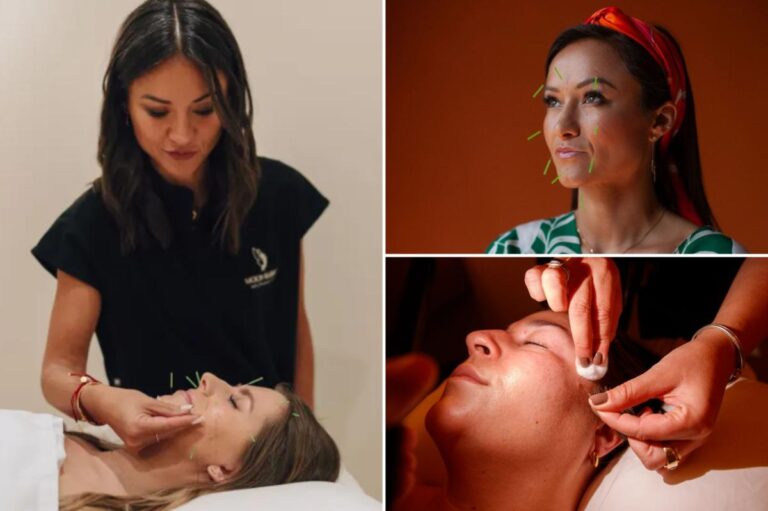 Exclusive | Botox enthusiasts are turning to acupuncture for smooth,