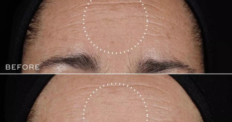 Save £33 on Medik8 anti ageing set with serum that 'replaced'