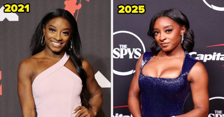 Why Simone Biles Opened For Boob Job, Eye Bag Op