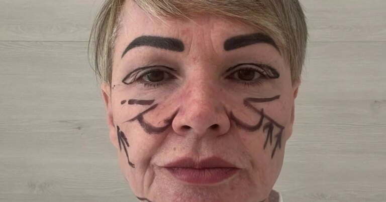 'I flew to Lithuania for an £8,000 facelift now