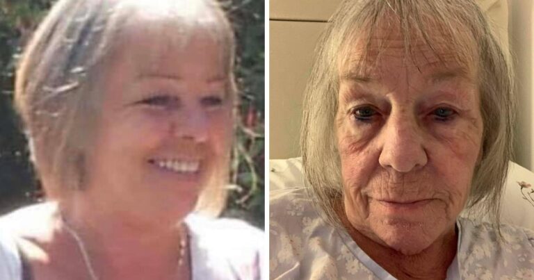Sussex woman spends thousands on Botox for back spasms Sussex woman spends thousands on Botox for back spasms