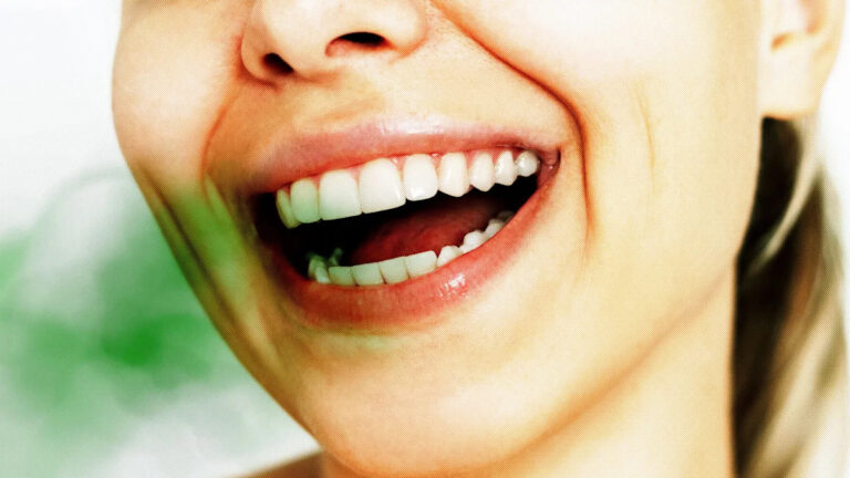 "Veneer Breath" plagues people with perfect smiles