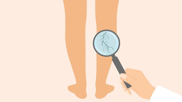 What doctors wish patients knew about chronic venous insufficiency
